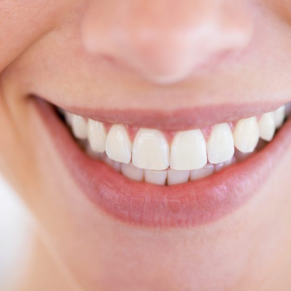 Close up of a woman's sparkling teeth