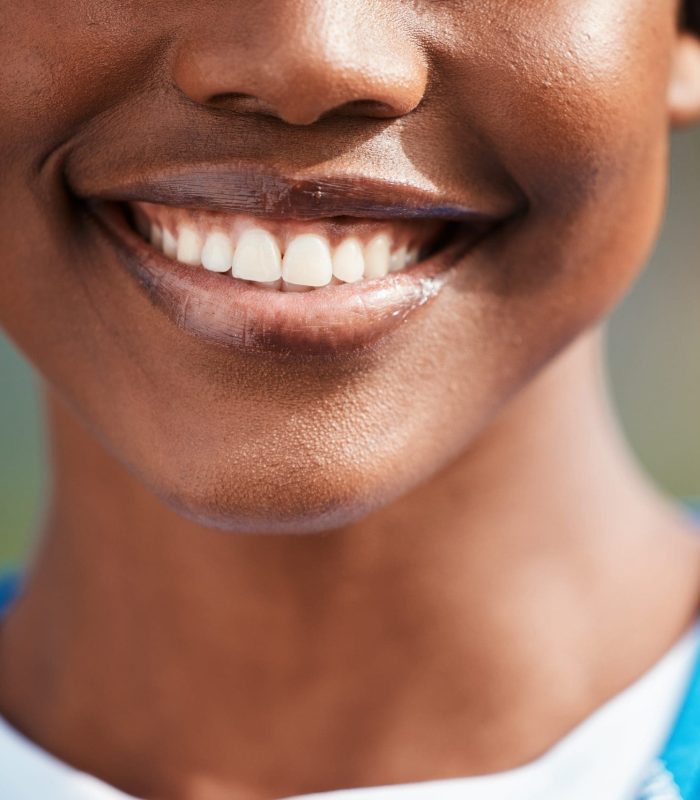 Dental, teeth and smile by black woman with oral hygiene, clean and whitening for self care with tooth implant. Healthcare, closeup and happy female person feeling excited for mouth wellness.