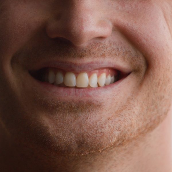 Cropped view unrecognizable Caucasian man smile toothy male teeth smiling happy joyful carefree cheerful guy home medical clinic orthodontic oral dentistry hygiene dental health whitening procedure. High quality 4k footage