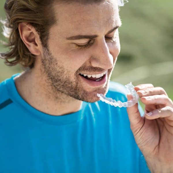 Positeeth-Invisalign-Man-1024×682 Positeeth-Invisalign-Man-1024x682